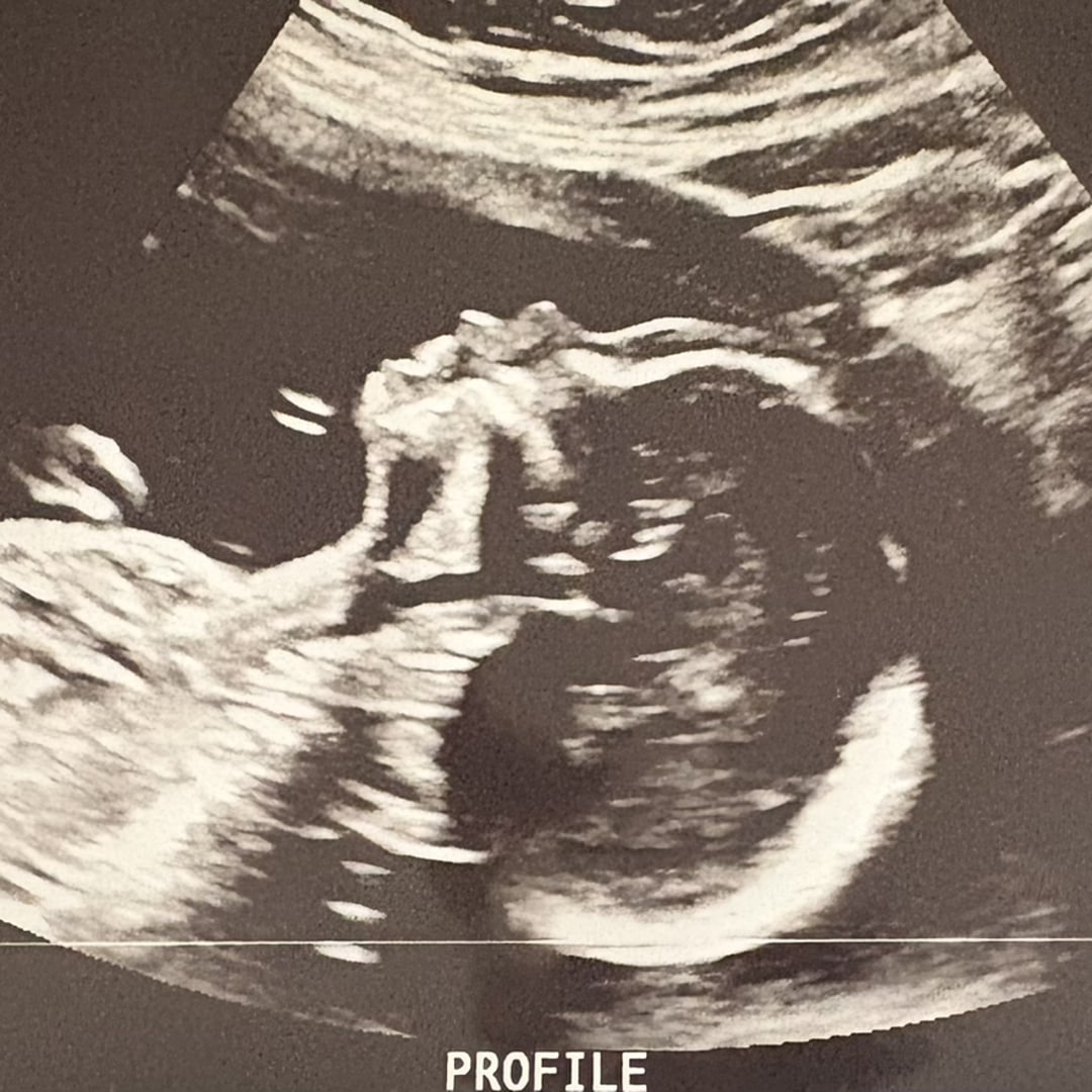 Photo shared by Carrie for their Babylist baby registry.