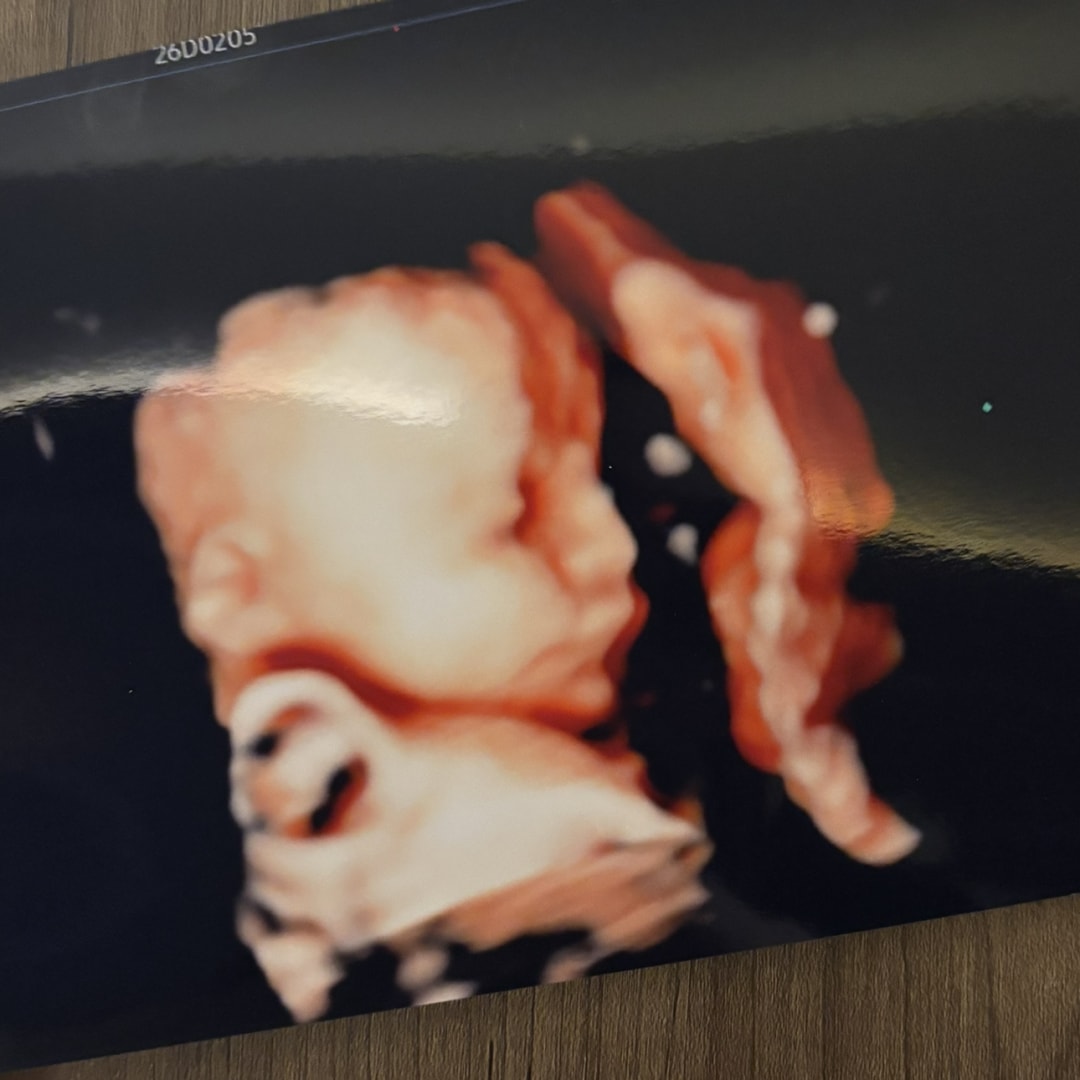 Photo shared by Fernanda for their Babylist baby registry.