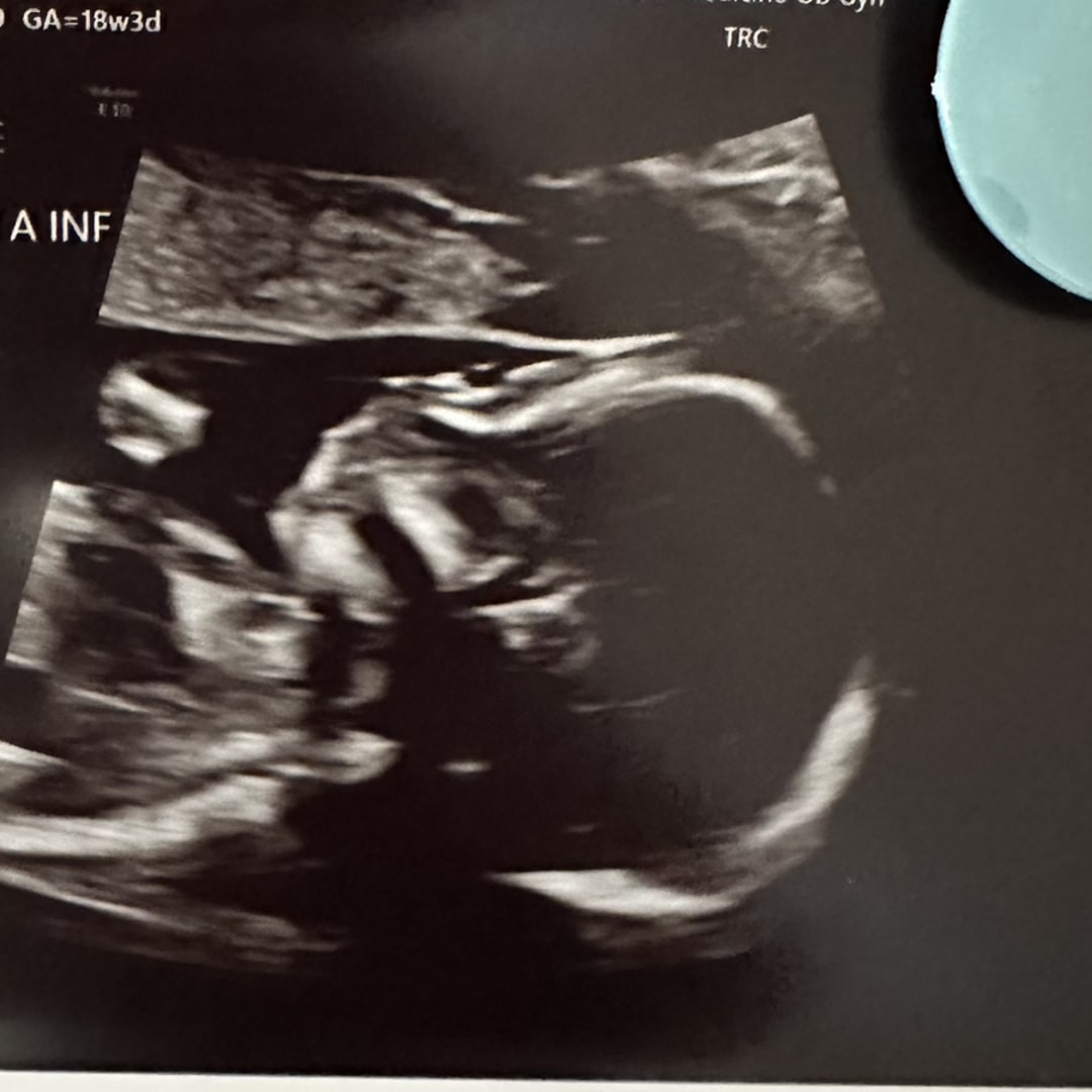 Photo shared by Erica for their Babylist baby registry.