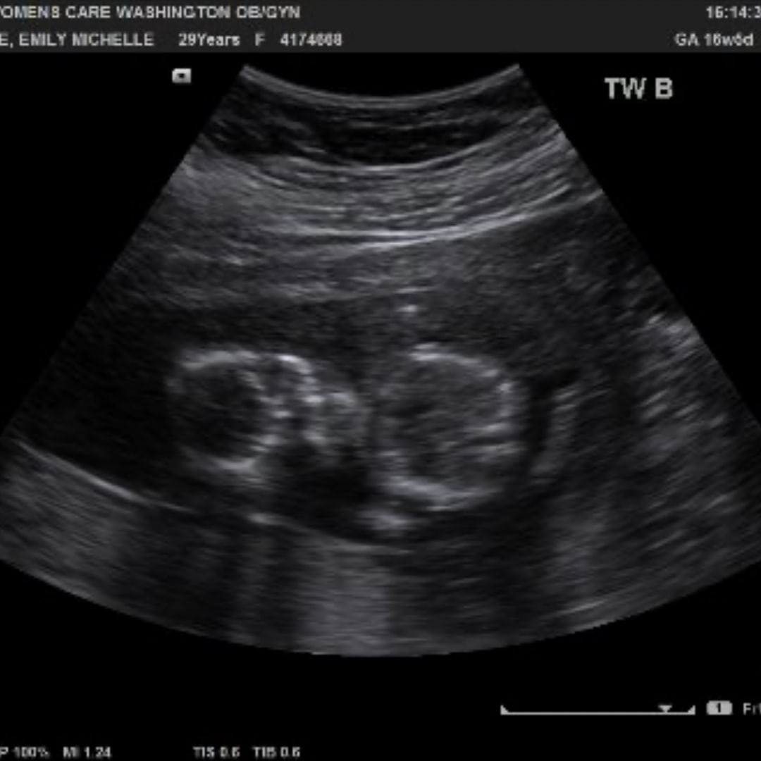 Photo shared by Emily for their Babylist baby registry.