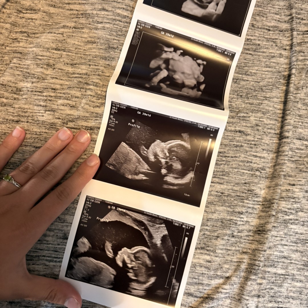 Photo shared by Cassidy for their Babylist baby registry.