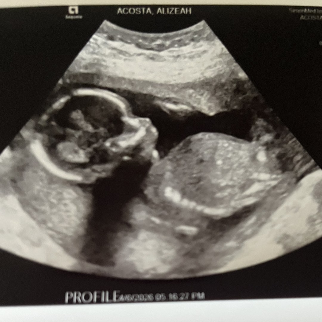 Photo shared by Alizeah for their Babylist baby registry.