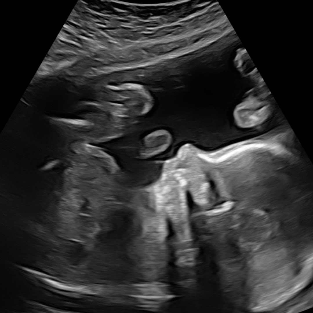 Photo shared by Baylee for their Babylist baby registry.