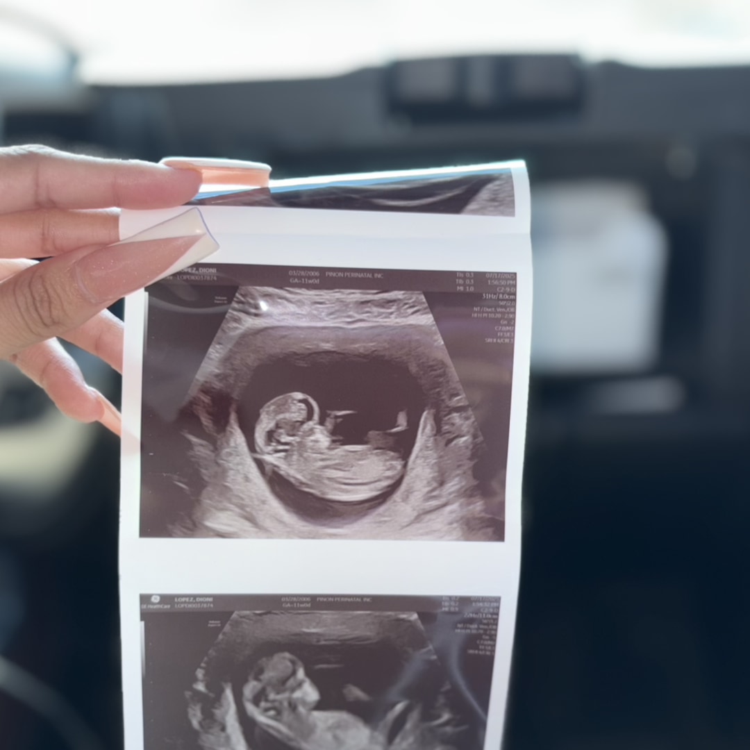 Photo shared by Arely for their Babylist baby registry.