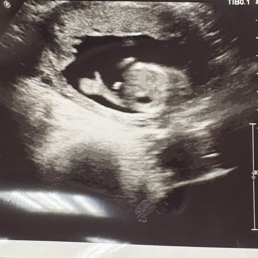 Photo shared by Emma for their Babylist baby registry.