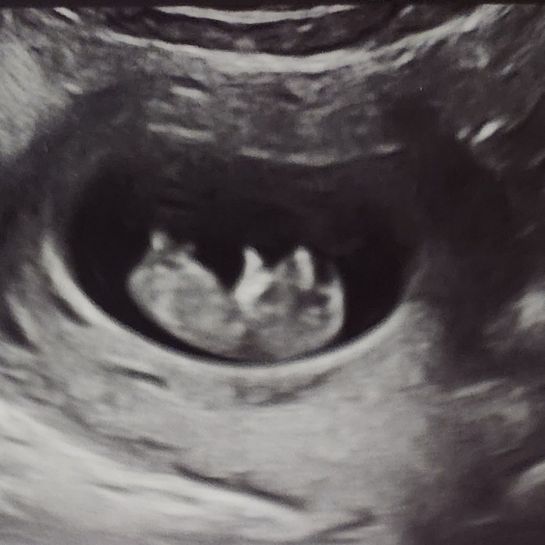 Photo shared by Erica for their Babylist baby registry.