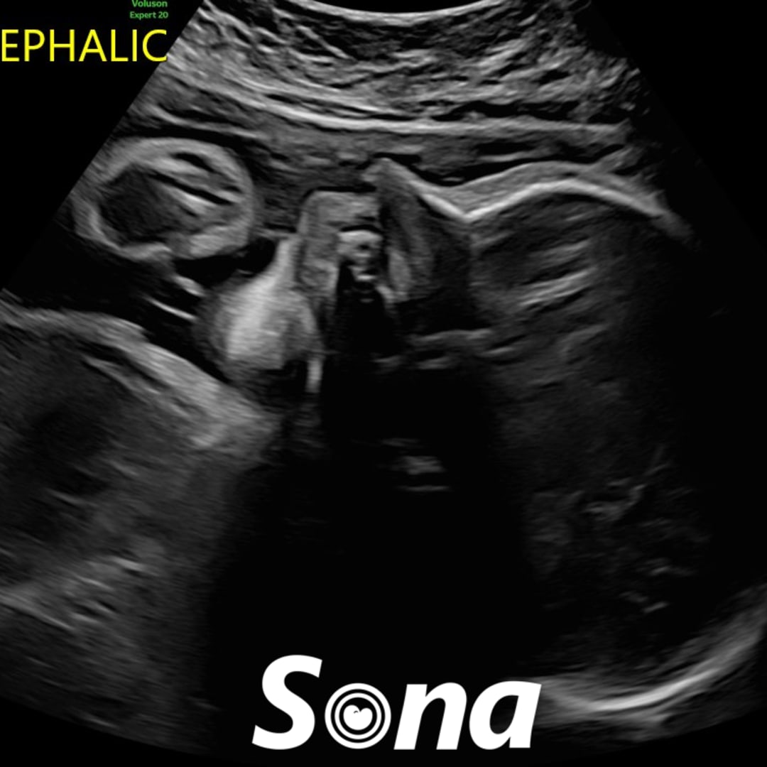 Photo shared by Evelyn for their Babylist baby registry.