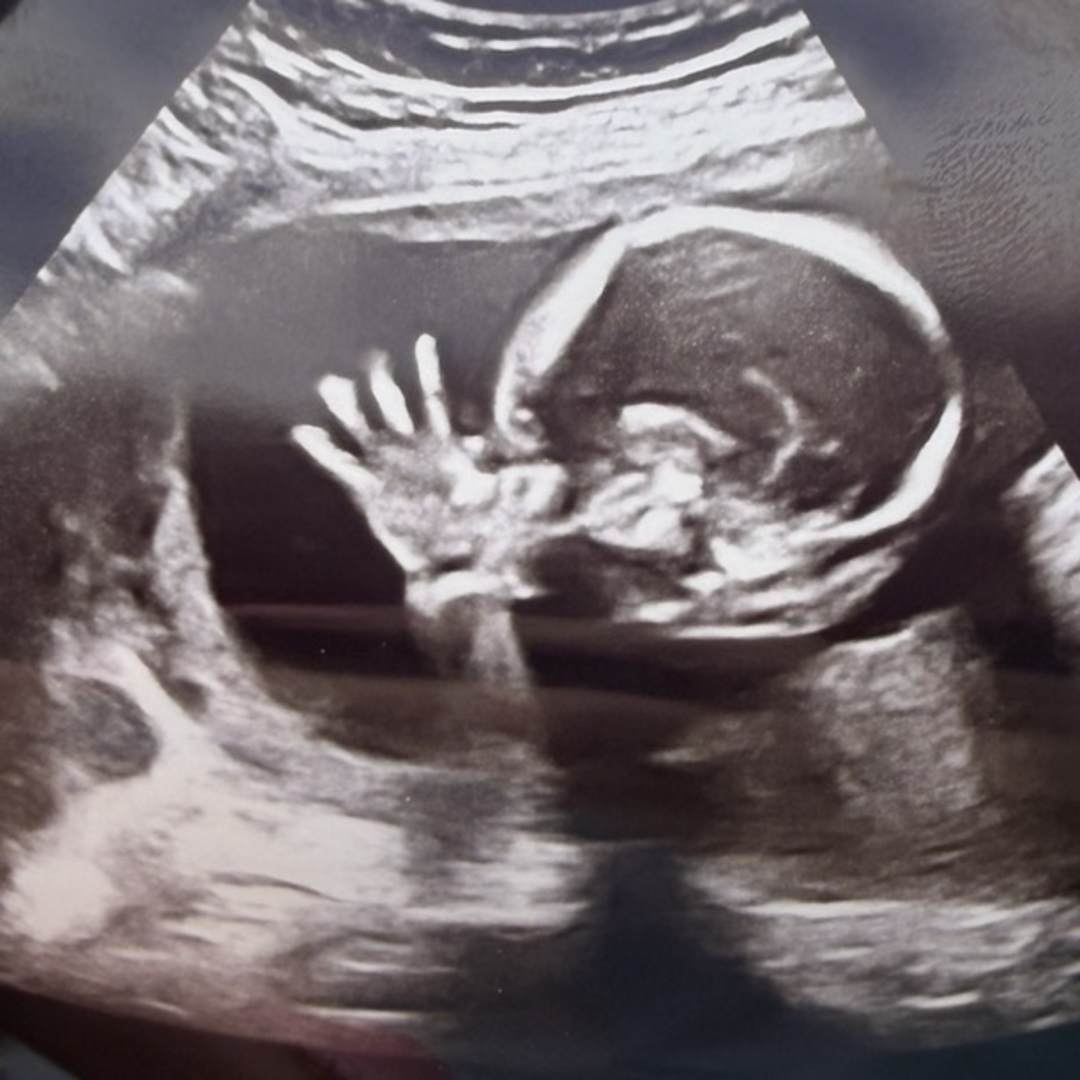 Photo shared by Marzena for their Babylist baby registry.