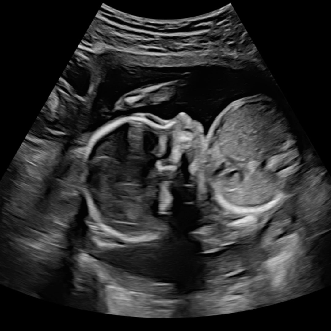 Photo shared by Koryn for their Babylist baby registry.