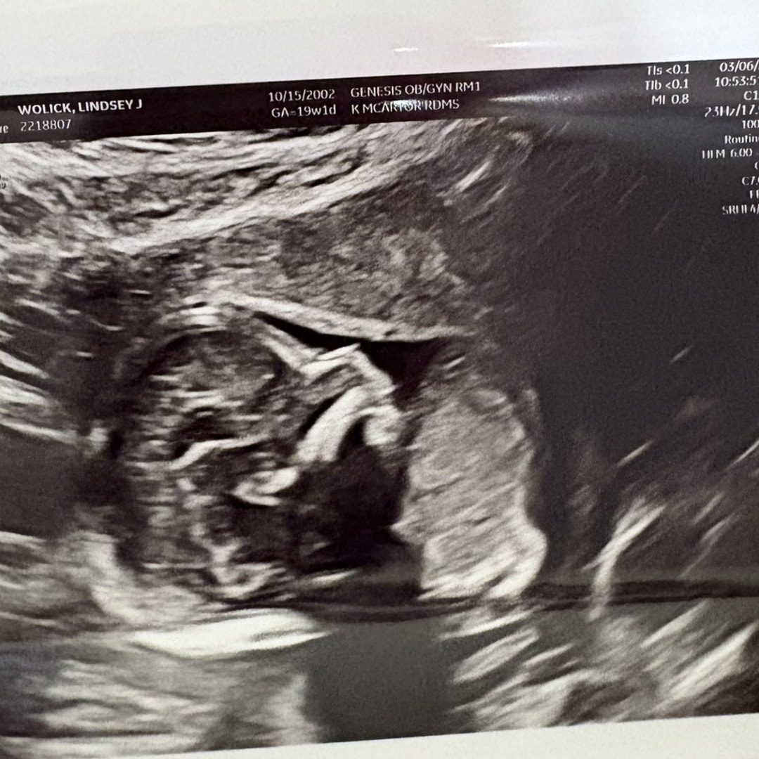 Photo shared by Lindsey for their Babylist baby registry.