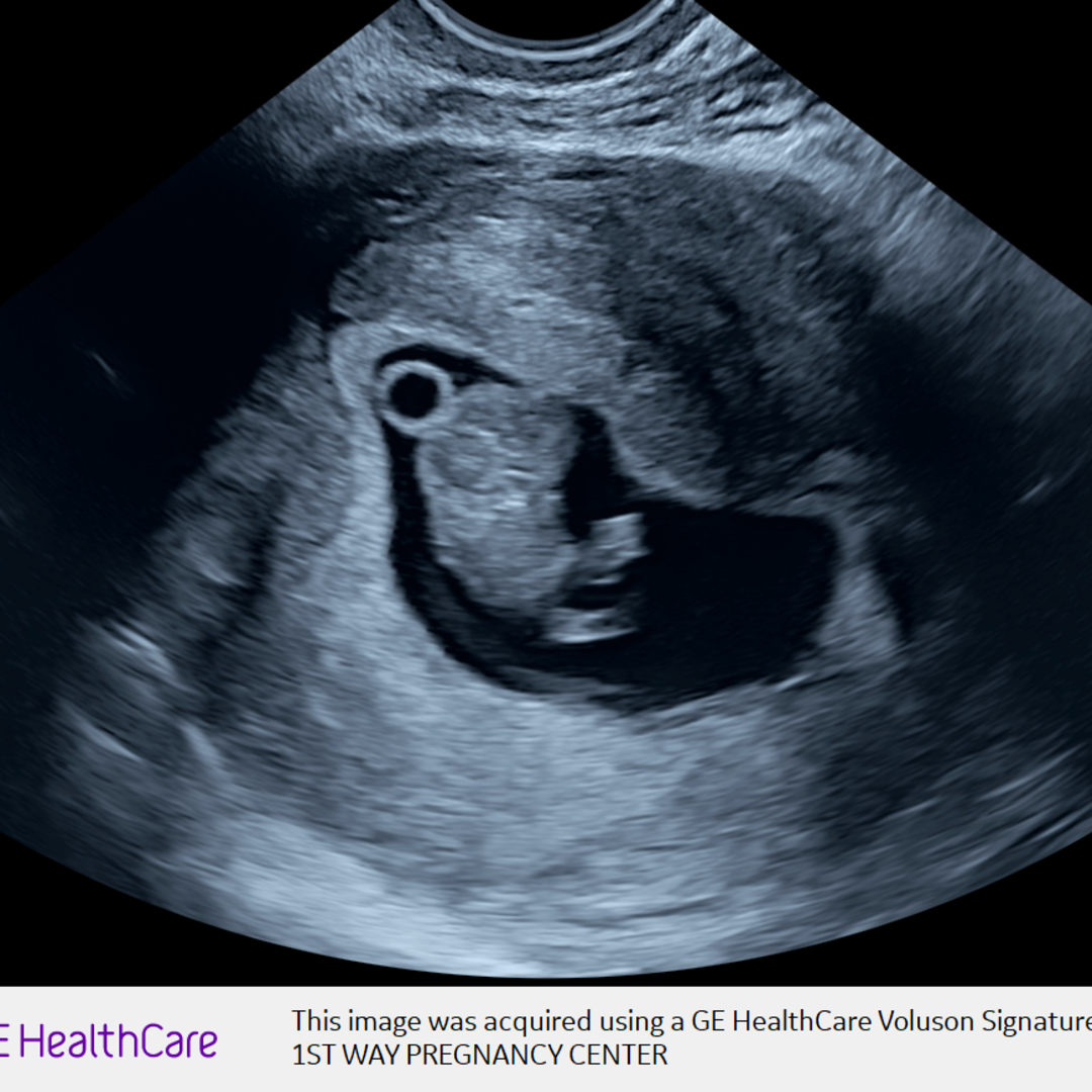 Photo shared by Jessica for their Babylist baby registry.