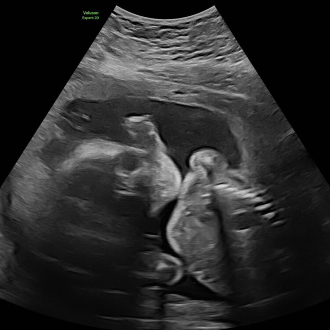 Photo shared by Emelyn for their Babylist baby registry.