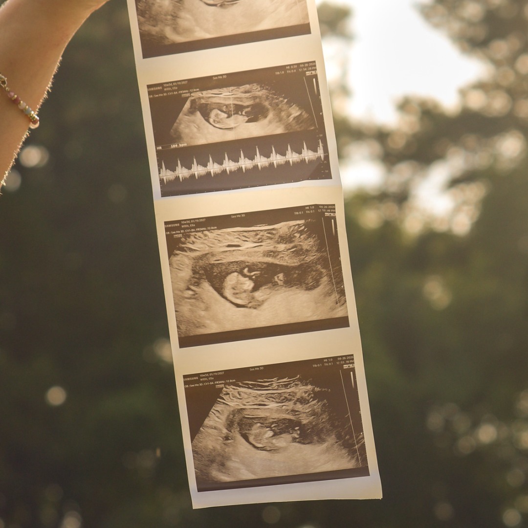 Photo shared by Ella for their Babylist baby registry.