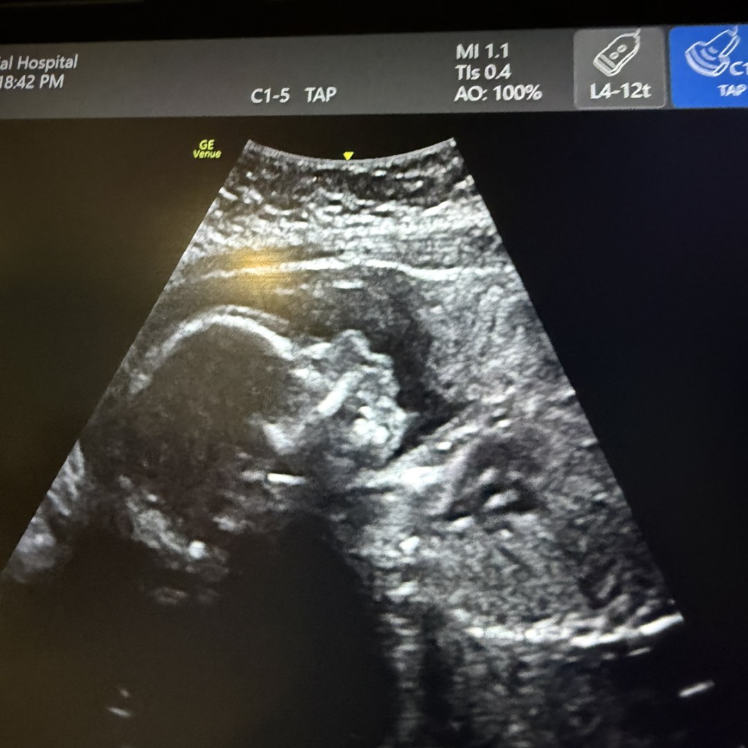 Photo shared by Katie for their Babylist baby registry.