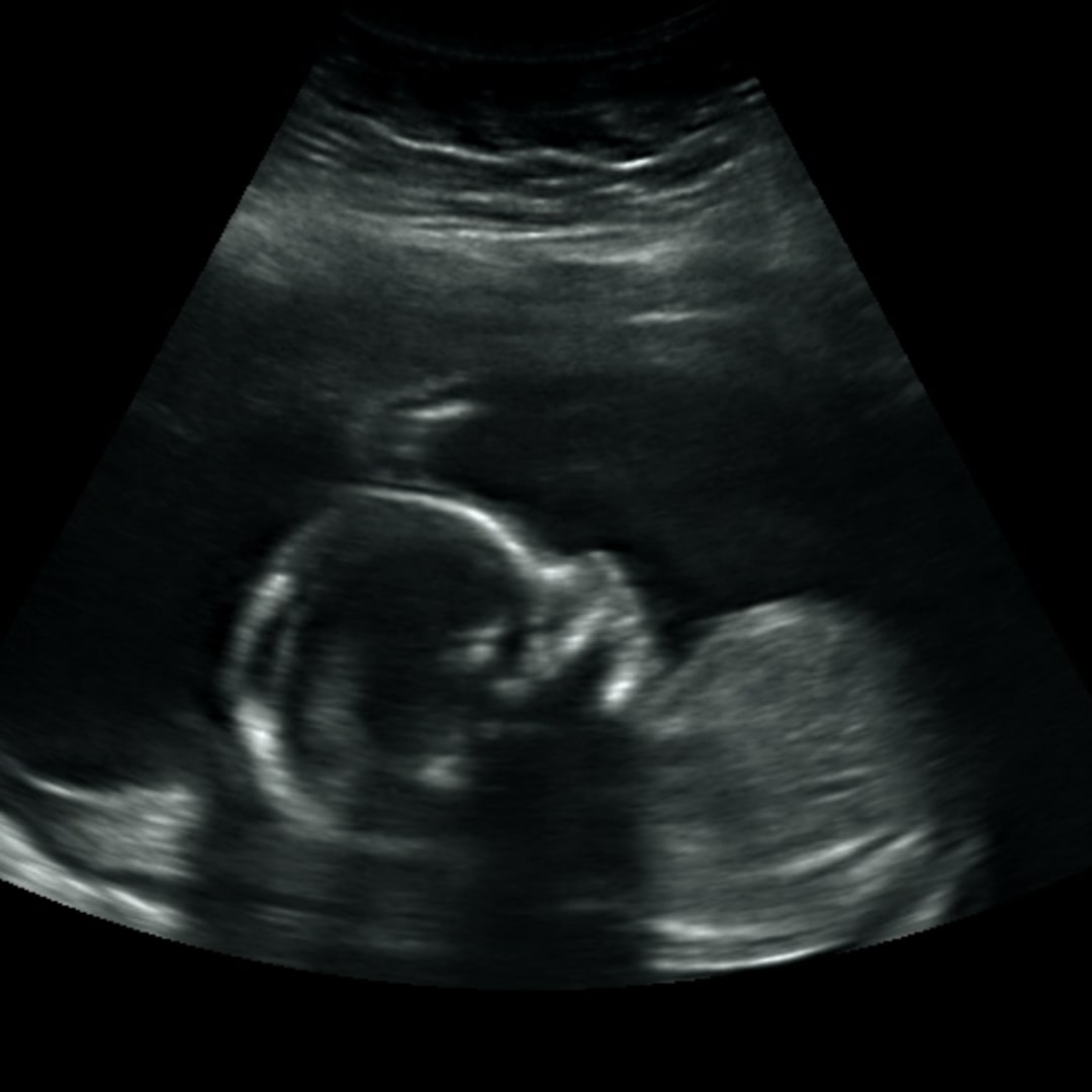Photo shared by Kiara for their Babylist baby registry.