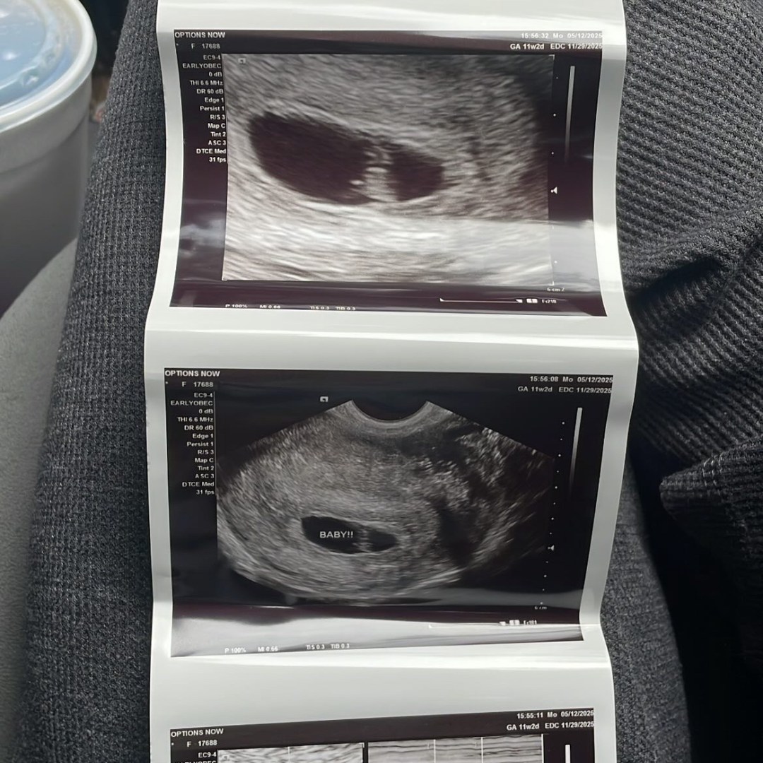 Photo shared by Ania for their Babylist baby registry.