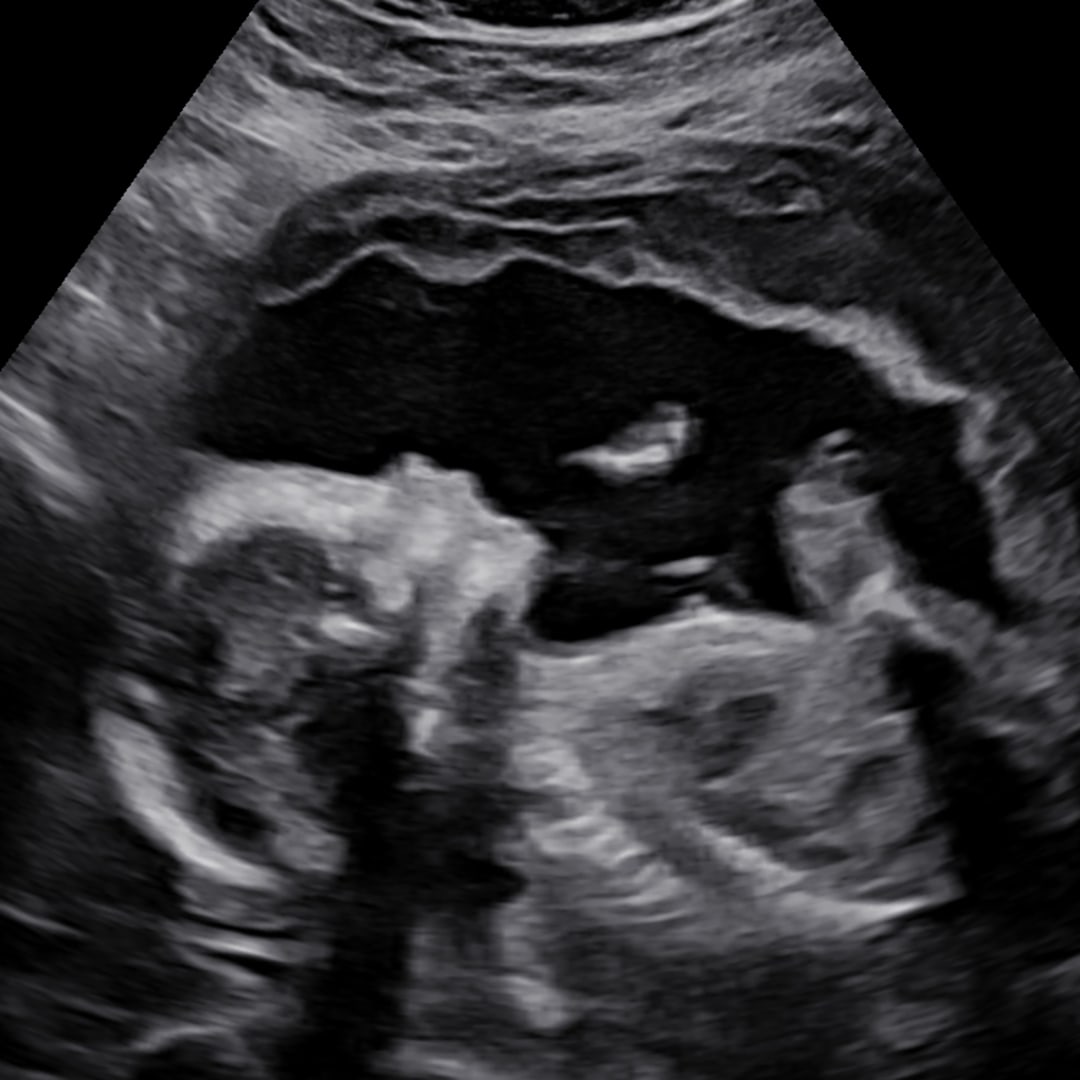 Photo shared by Allysa for their Babylist baby registry.