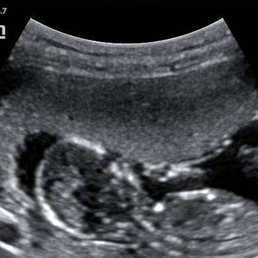 Photo shared by Joe for their Babylist baby registry.