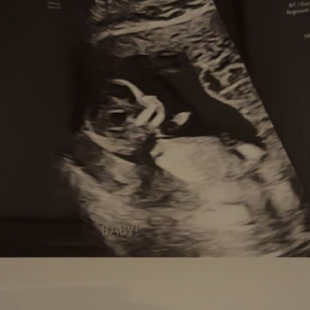 Photo shared by Skye for their Babylist baby registry.