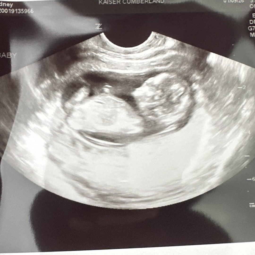 Photo shared by Sydney for their Babylist baby registry.