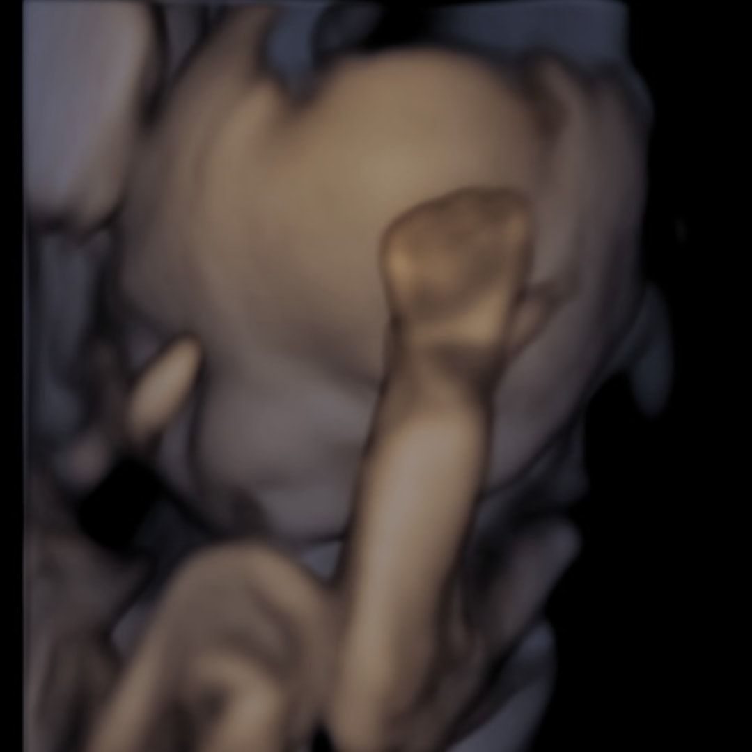 Photo shared by Morgan for their Babylist baby registry.