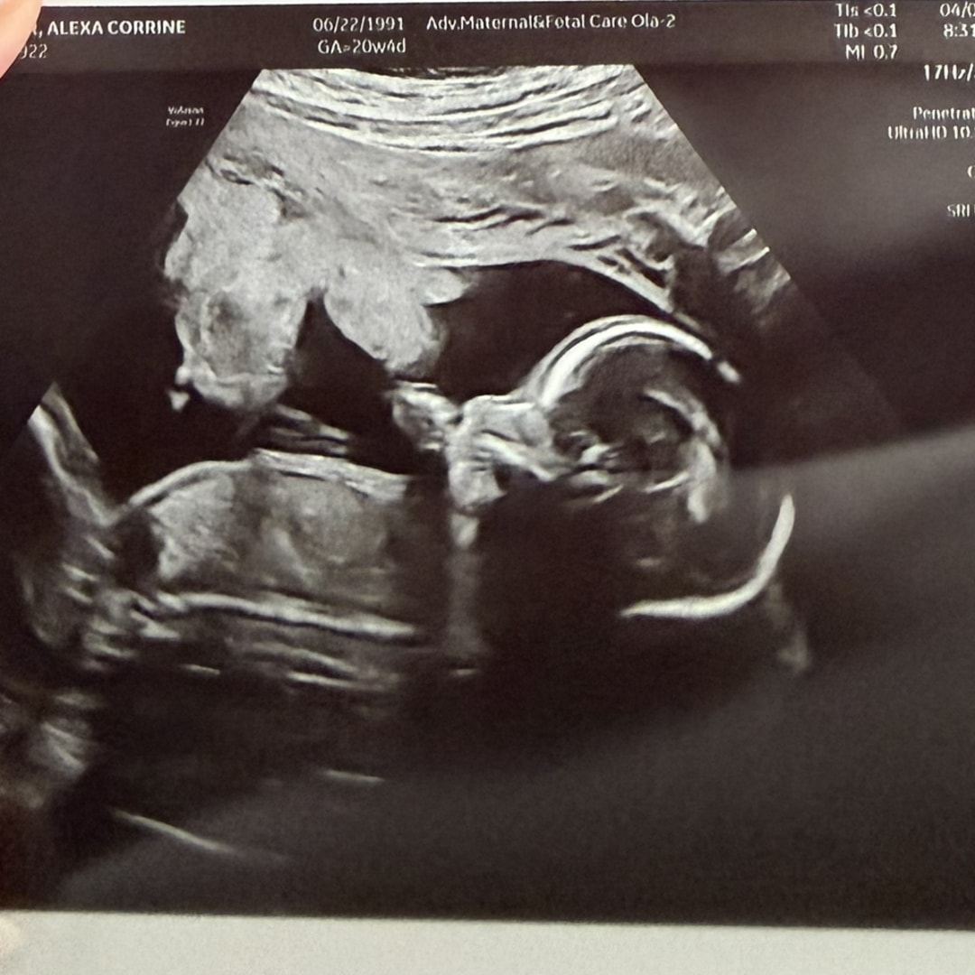 Photo shared by Alexa/Lexi for their Babylist baby registry.