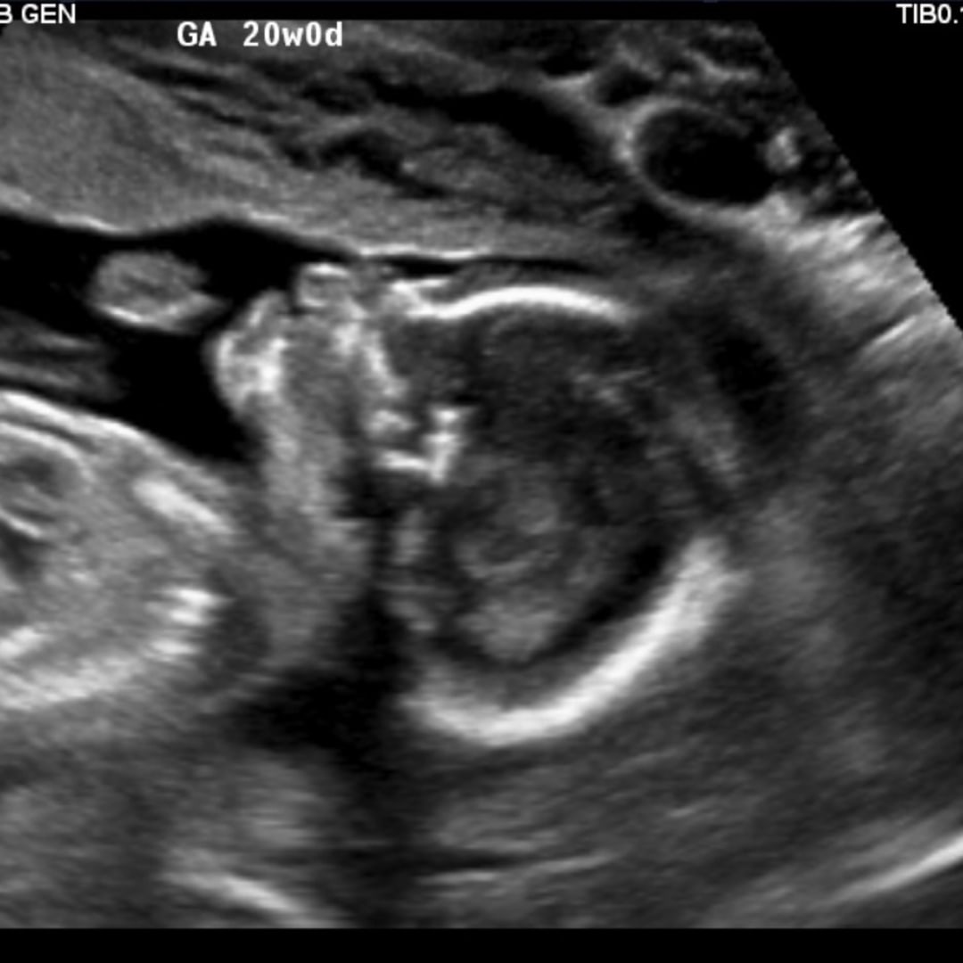 Photo shared by Ariyanna for their Babylist baby registry.