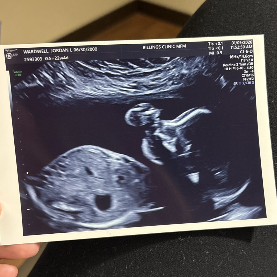 Photo shared by Jordan for their Babylist baby registry.