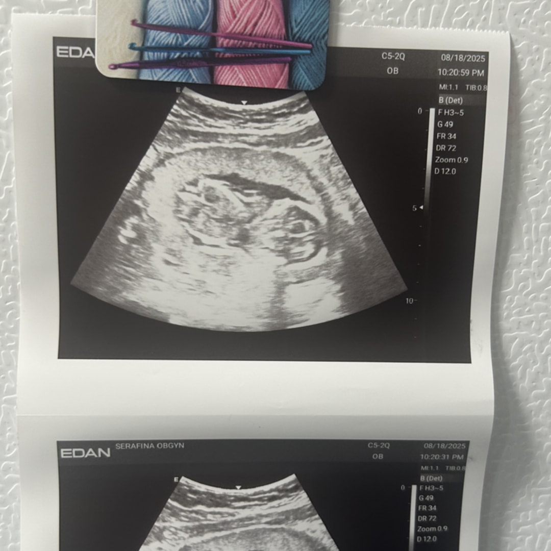 Photo shared by Katherine for their Babylist baby registry.