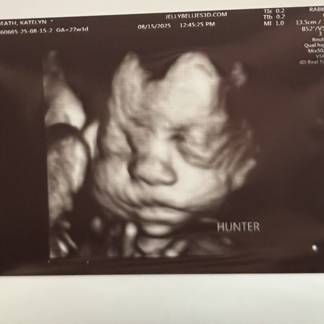 Photo shared by Katelyn for their Babylist baby registry.