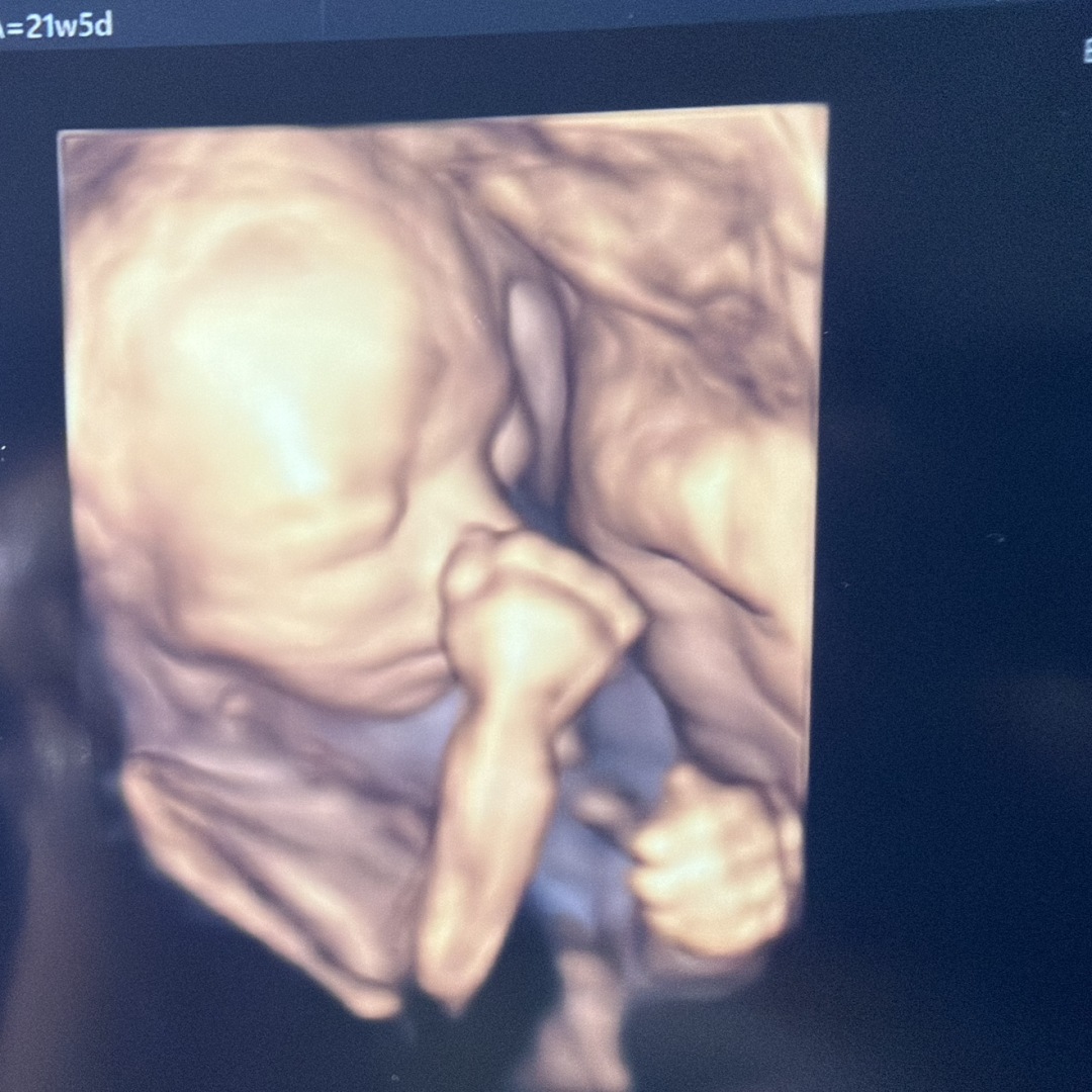 Photo shared by Alani for their Babylist baby registry.