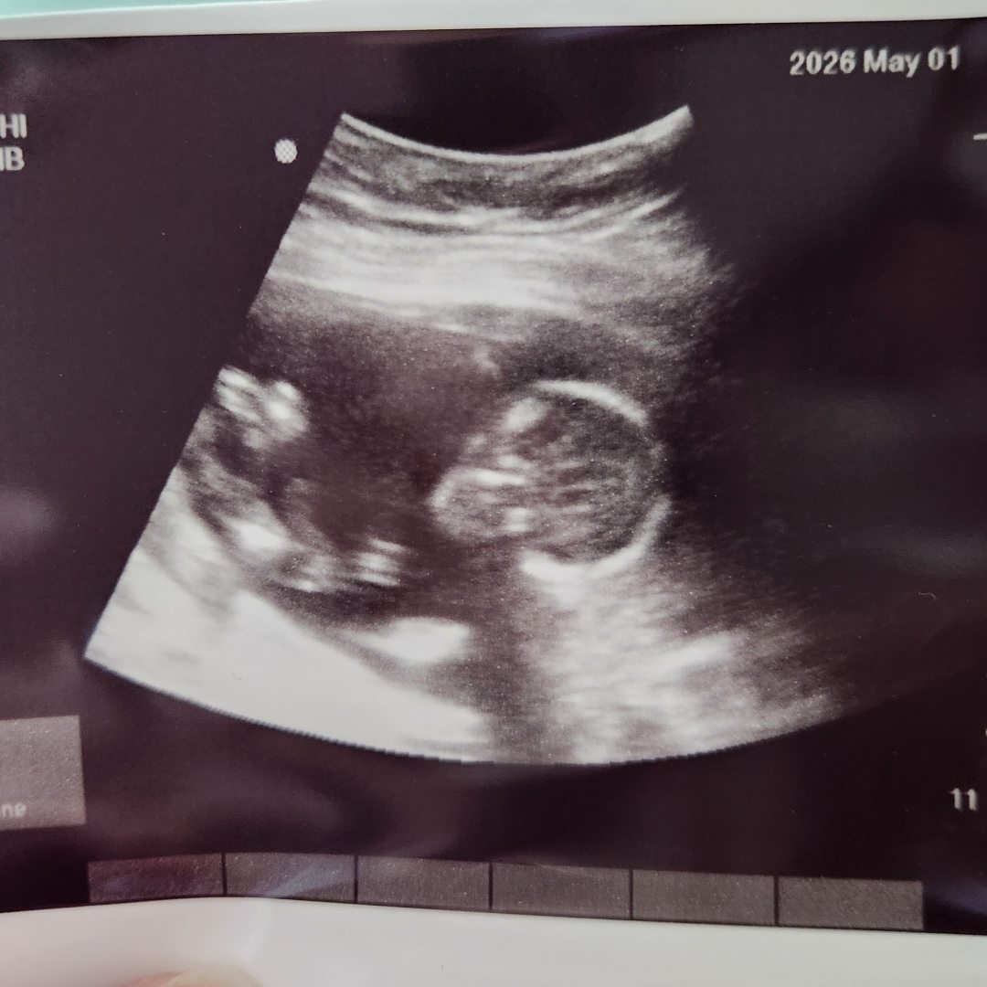 Photo shared by Amber for their Babylist baby registry.