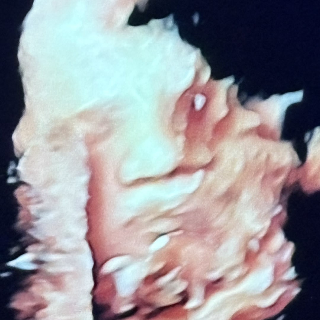 Photo shared by Vin for their Babylist baby registry.