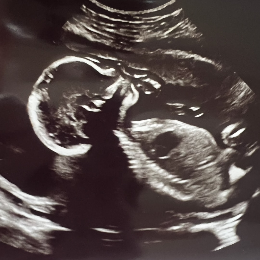 Photo shared by Alyssa for their Babylist baby registry.