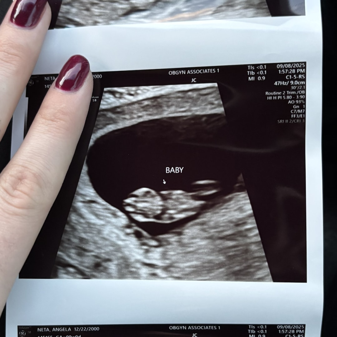 Photo shared by Angela for their Babylist baby registry.