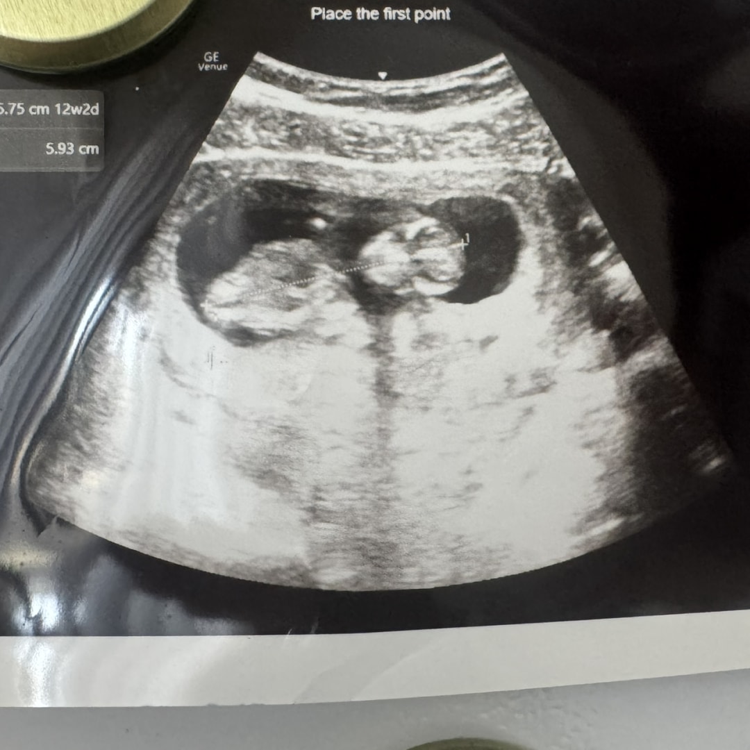 Photo shared by Kaelyn for their Babylist baby registry.