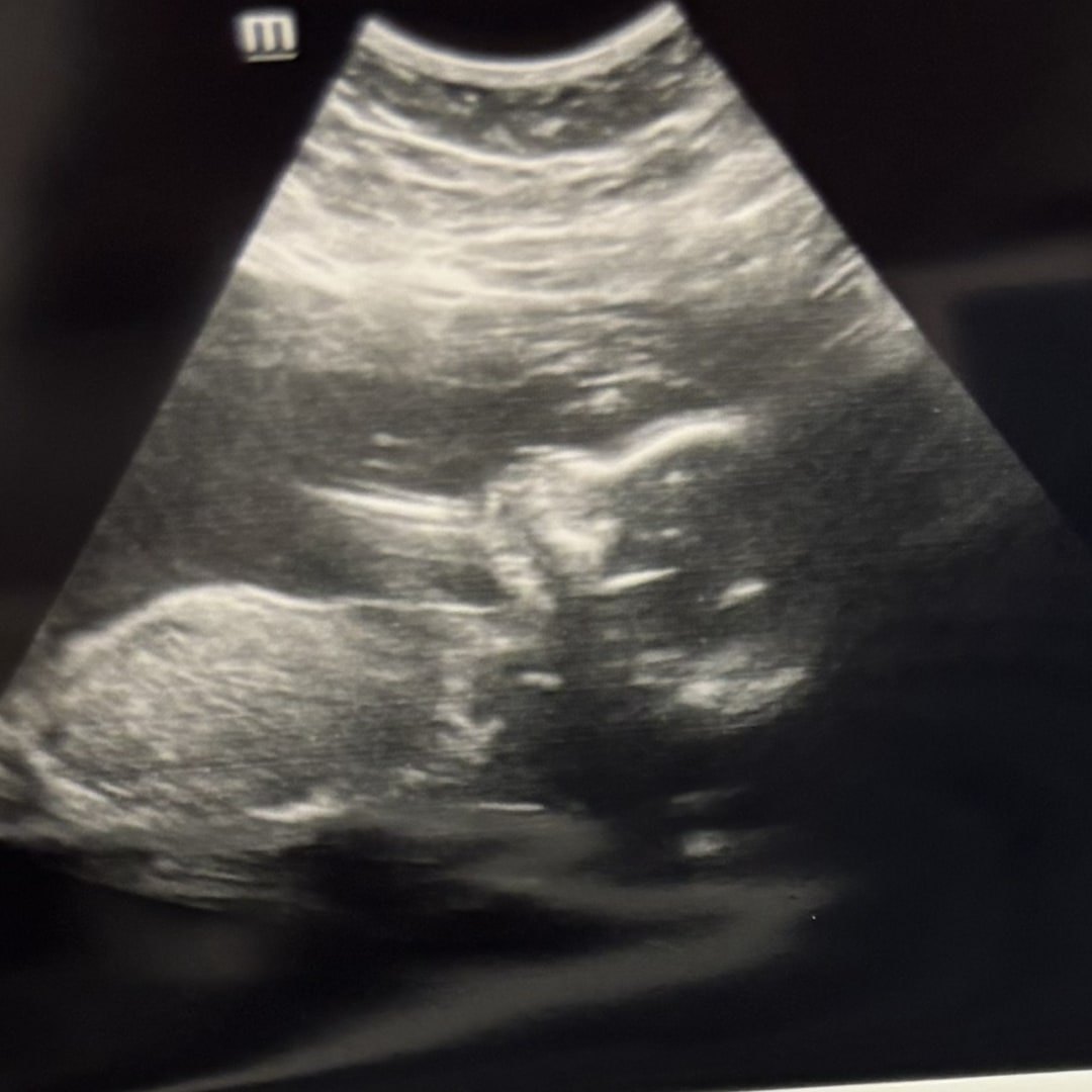 Photo shared by Ann Marie for their Babylist baby registry.