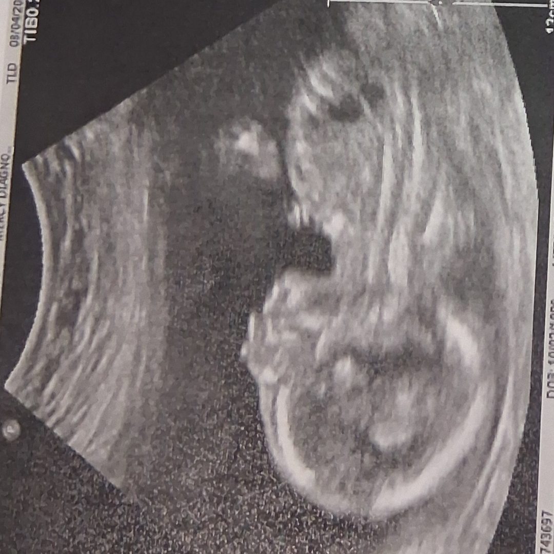 Photo shared by Ariana for their Babylist baby registry.