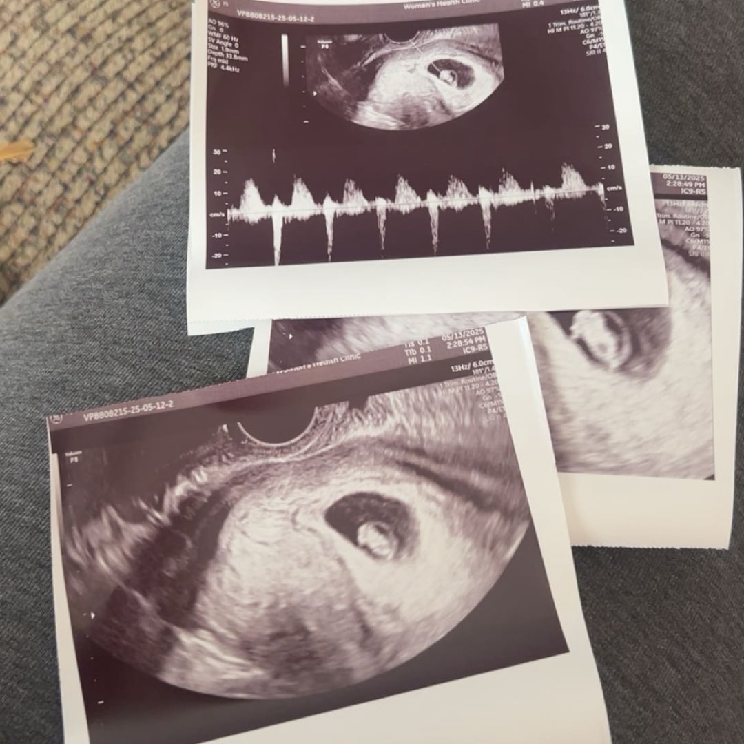 Photo shared by Alyssa for their Babylist baby registry.