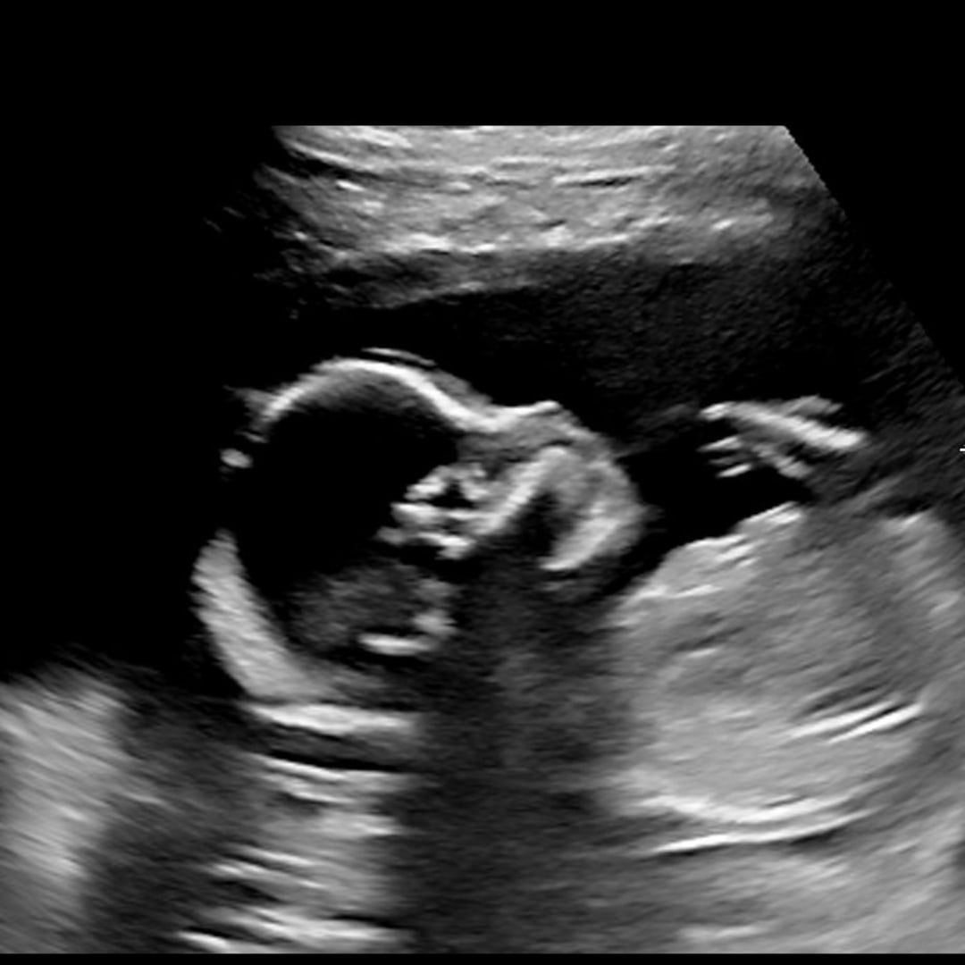 Photo shared by Morgan for their Babylist baby registry.