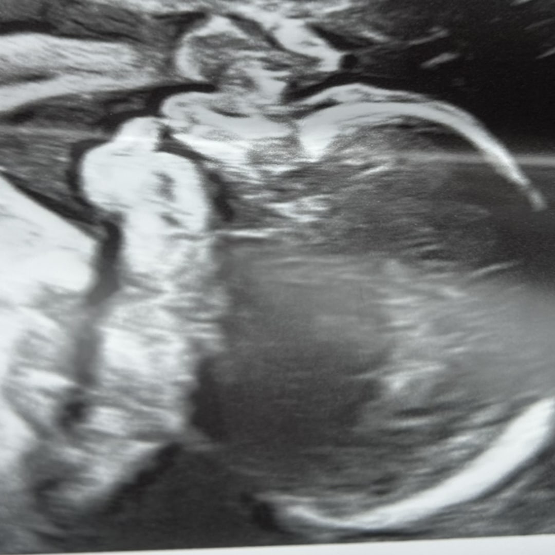 Photo shared by Janea for their Babylist baby registry.