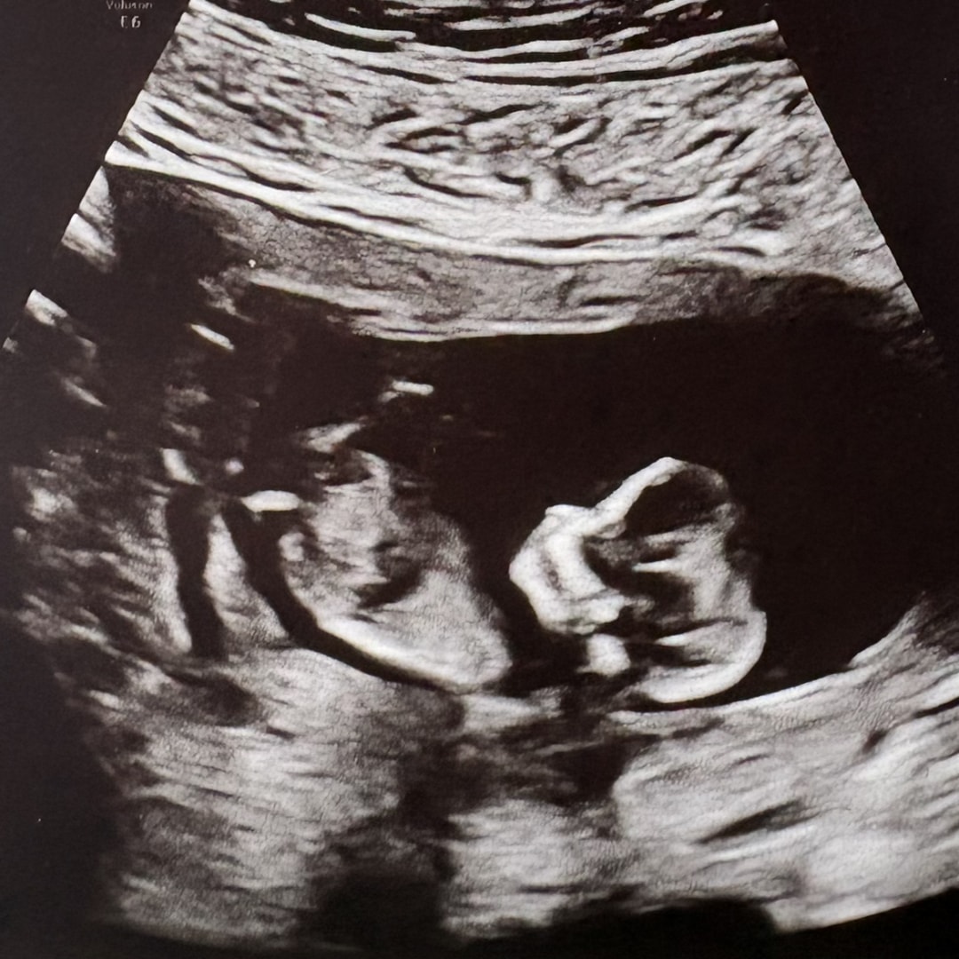 Photo shared by Lauren for their Babylist baby registry.