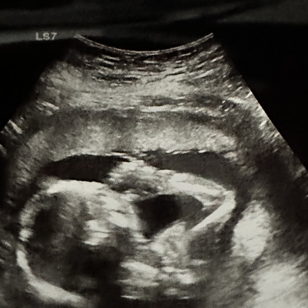 Photo shared by Christina for their Babylist baby registry.