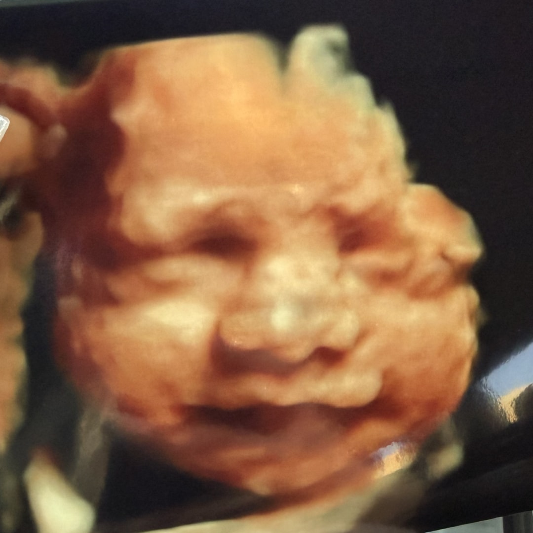 Photo shared by Janet for their Babylist baby registry.