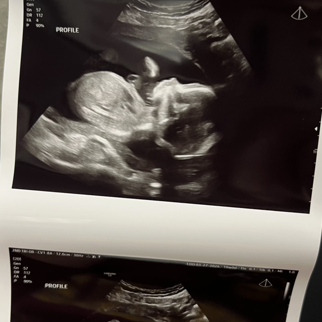 Photo shared by Julie for their Babylist baby registry.