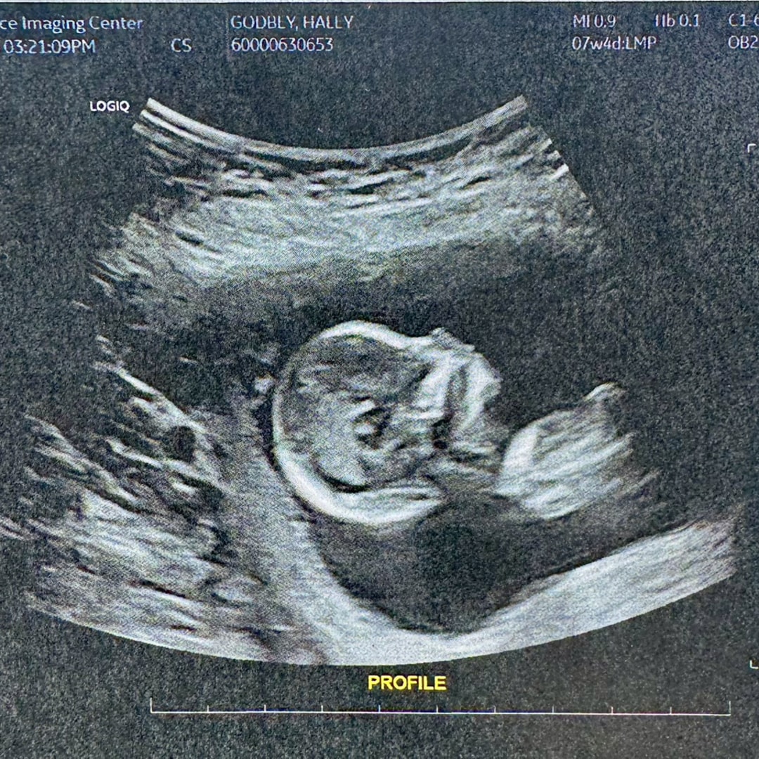 Photo shared by Haley for their Babylist baby registry.