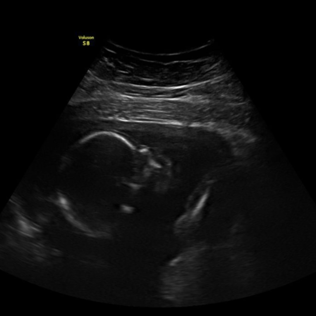 Photo shared by Desteny for their Babylist baby registry.