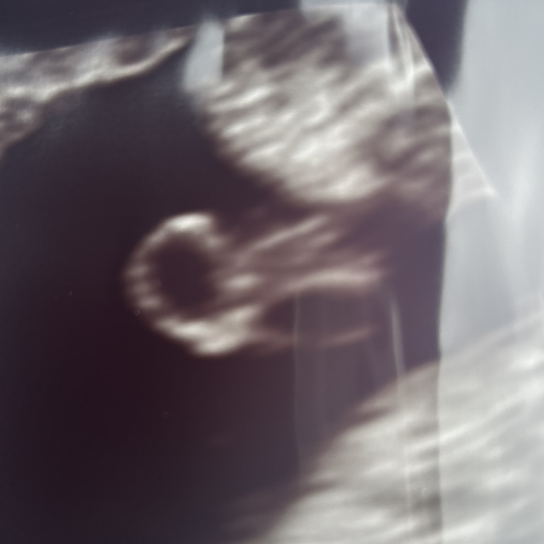 Photo shared by Danielle for their Babylist baby registry.