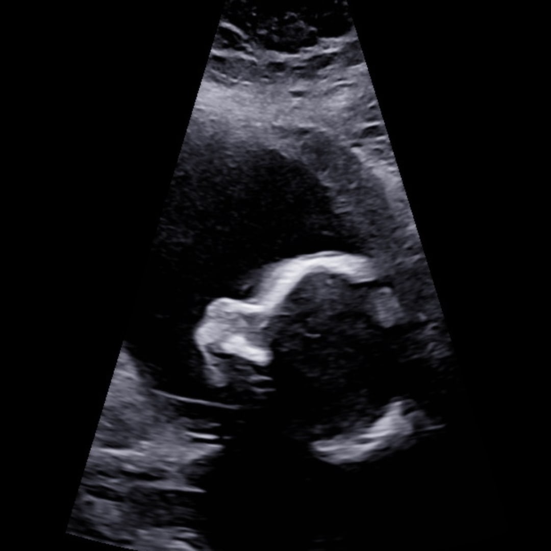 Photo shared by Caitlin for their Babylist baby registry.