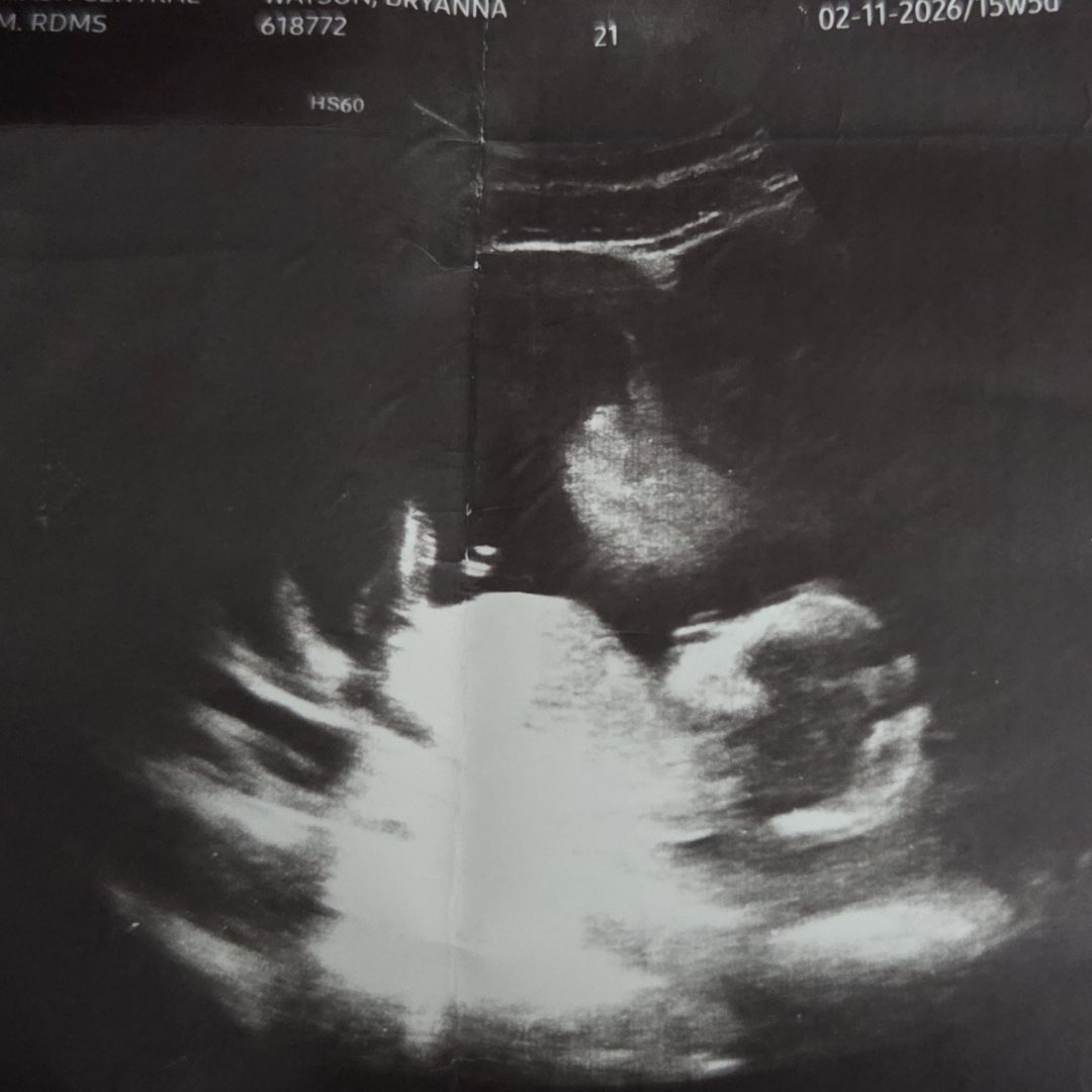 Photo shared by Bryanna for their Babylist baby registry.